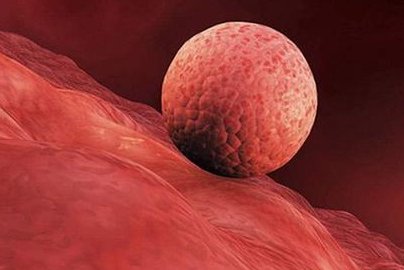 借助科技的力量，nic医院的三代试管技术助您生育