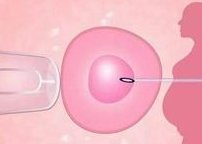 厦门比较大的助孕机构介绍，附前3名单